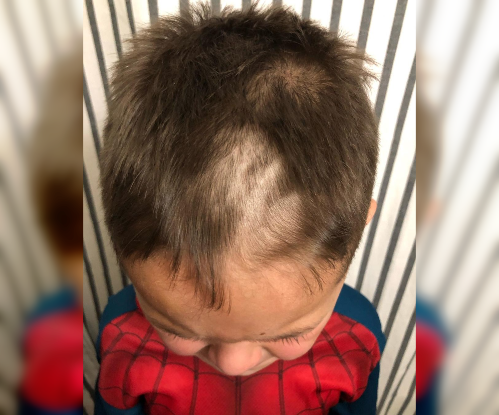 DIY Disasters: Kids and Their Crazy Hairstyling Attempts